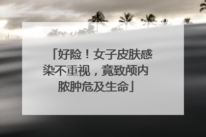 好险！女子皮肤感染不重视，竟致颅内脓肿危及生命